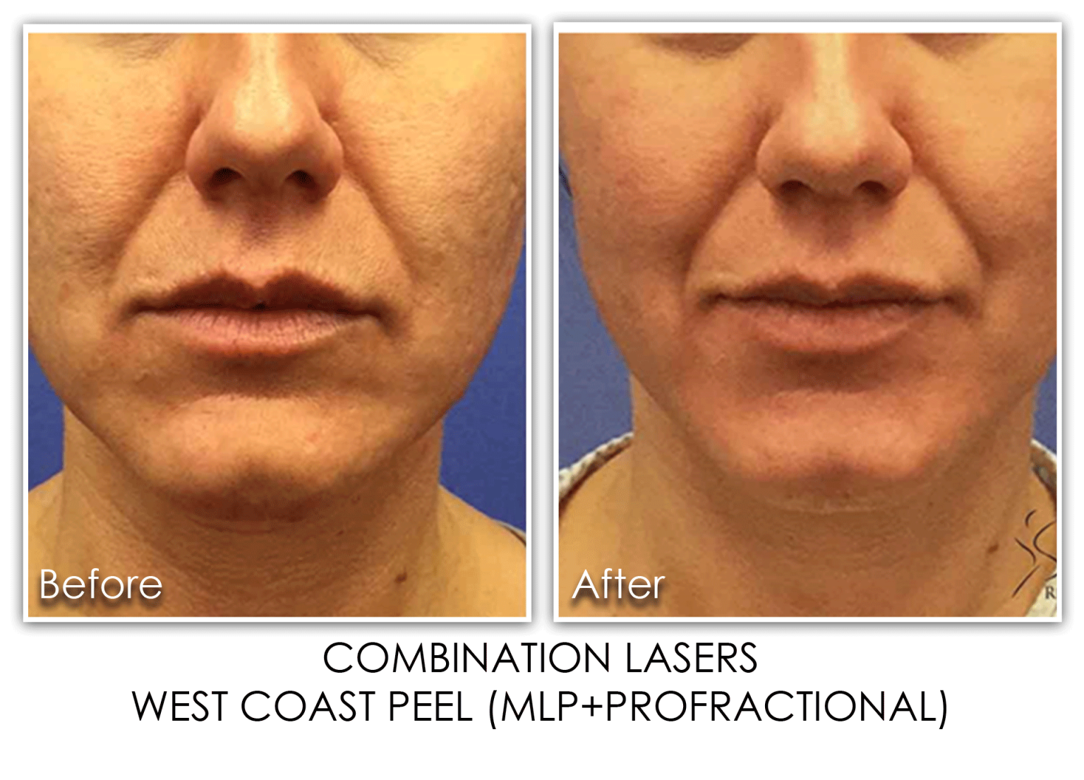 Galleries Archive - Page 12 of 22 - Skin Rejuvenation Clinic Skin